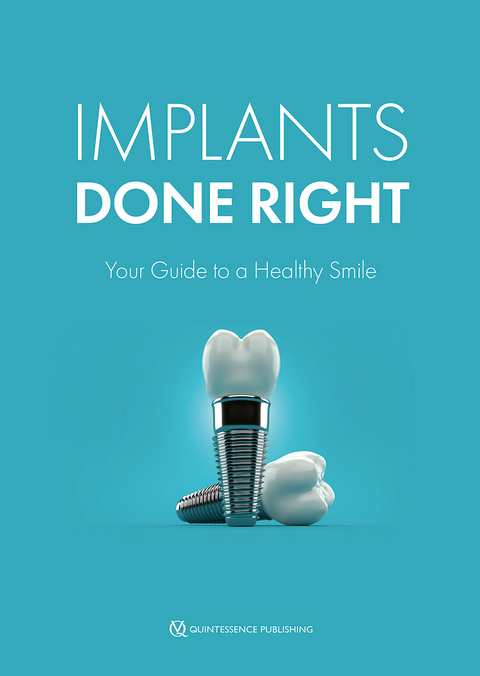 Implants Done Right - John W Thousand