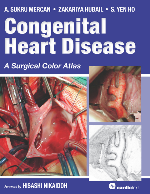 Congenital Heart Disease: A Surgical Color Atlas -  S. Yen Ho,  Zakariya Hubail,  A. Sukru Mercan