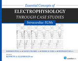 Essential Concepts of Electrophysiology through Case Studies: Intracardiac EGMs -  David Frankel,  Roderick Tung