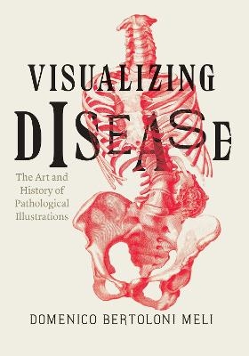 Visualizing Disease - Domenico Bertoloni Meli