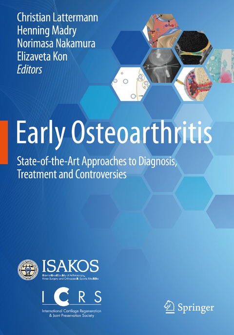 Early Osteoarthritis - 