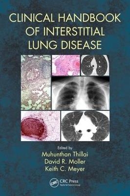 Clinical Handbook of Interstitial Lung Disease - 