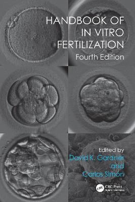 Handbook of In Vitro Fertilization - 