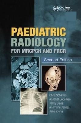 Paediatric Radiology for MRCPCH and FRCR, Second Edition - Copeman Copeman