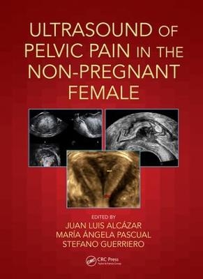 Ultrasound of Pelvic Pain in the Non-Pregnant Patient - 