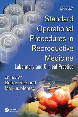 Standard Operational Procedures in Reproductive Medicine - 