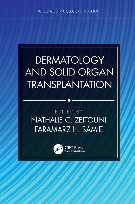 Dermatology and Solid Organ Transplantation - 
