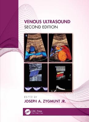 Venous Ultrasound - 