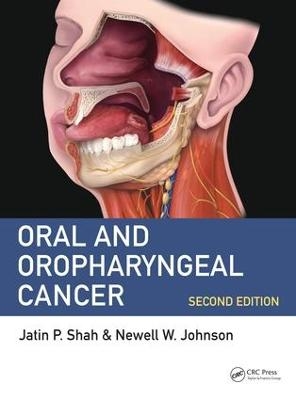 Oral and Oropharyngeal Cancer - 