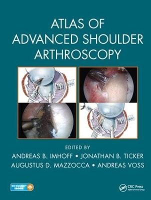 Atlas of Advanced Shoulder Arthroscopy - 