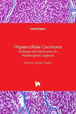 Hepatocellular Carcinoma - 