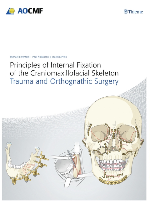 Principles of Internal Fixation of the Craniomaxillofacial Skeleton - Joachim Prein, Michael Ehrenfeld, Paul N. Manson