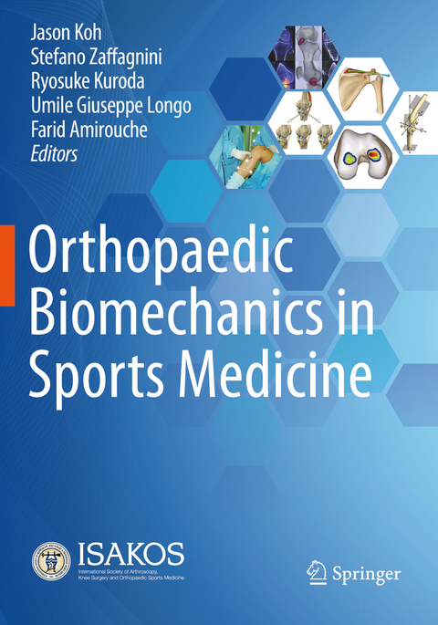 Orthopaedic Biomechanics in Sports Medicine - 