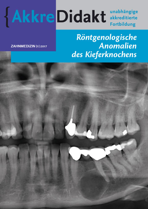 Röntgenologische Anomalien des Kieferknochens - Isaac Van Der Waal