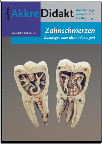 Zahnschmerzen, odontogen oder nicht-odontogen? - Jan Warnsinck