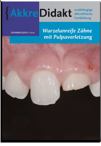 Wurzelunreife Zähne mit Pulpaverletzung - Marga Ree