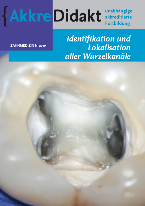 Identifikation und Lokalisation aller Wurzelkanäle - Michael Drefs