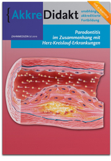 Parodontitis im Zusammenhang mit Herz-Kreislauf-Erkrankungen - Bruno Loos