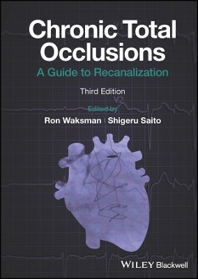Chronic Total Occlusions - 