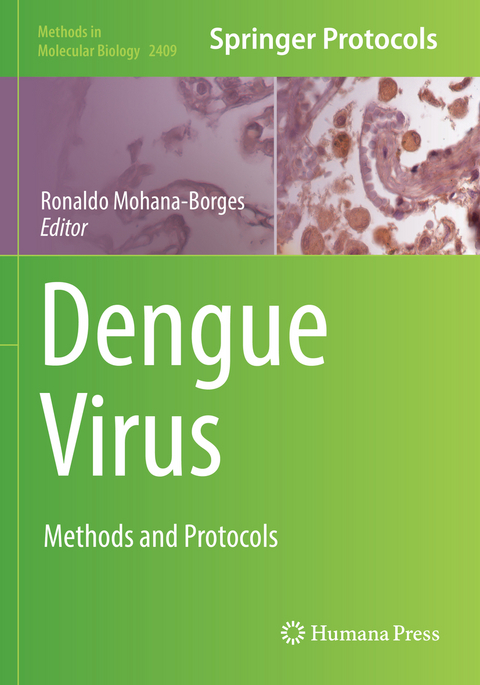 Dengue Virus - 