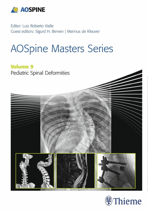AOSpine Masters Series, Volume 9: Pediatric Spinal Deformities - 