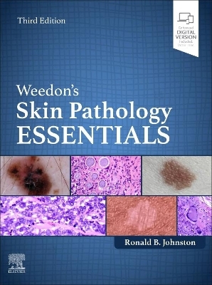 Weedon's Skin Pathology Essentials - Ronald Johnston