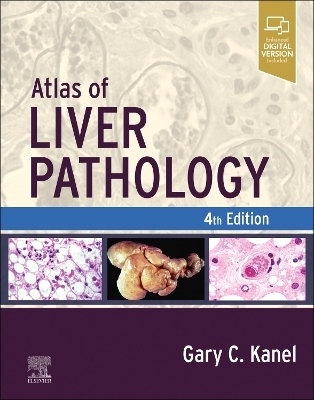 Atlas of Liver Pathology - Gary C. Kanel