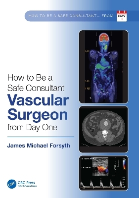 How to be a Safe Consultant Vascular Surgeon from Day One - James Forsyth