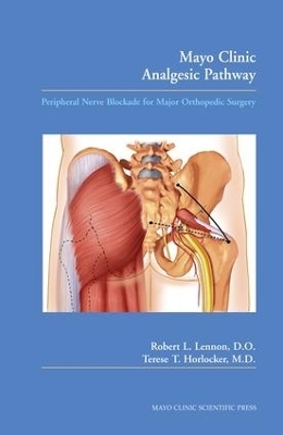 Mayo Clinic Analgesic Pathway - Robert L. Lennon, Terese T. Horlocker