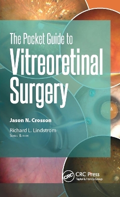 The Pocket Guide to Vitreoretinal Surgery - Jason Crosson