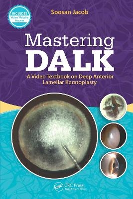 Mastering DALK - Soosan Jacob