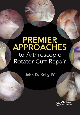 Premier Approaches to Arthroscopic Rotator Cuff Repair - John Kelly