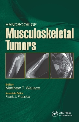 Handbook of Musculoskeletal Tumors - Matthew Wallace, Frank Frassica
