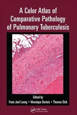 A Color Atlas of Comparative Pathology of Pulmonary Tuberculosis - 