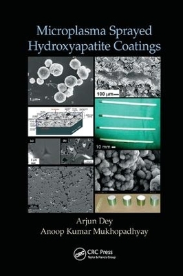 Microplasma Sprayed Hydroxyapatite Coatings - Arjun Dey, Anoop Kumar Mukhopadhyay