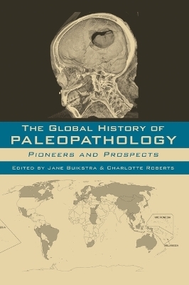 The Global History of Paleopathology - 