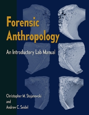 Forensic Anthropology - Christopher M. Stojanowski and Andrew C. Seidel, Andrew C. Seidel