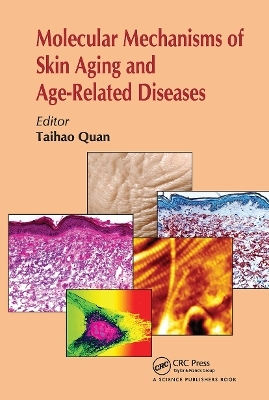 Molecular Mechanisms of Skin Aging and Age-Related Diseases - 