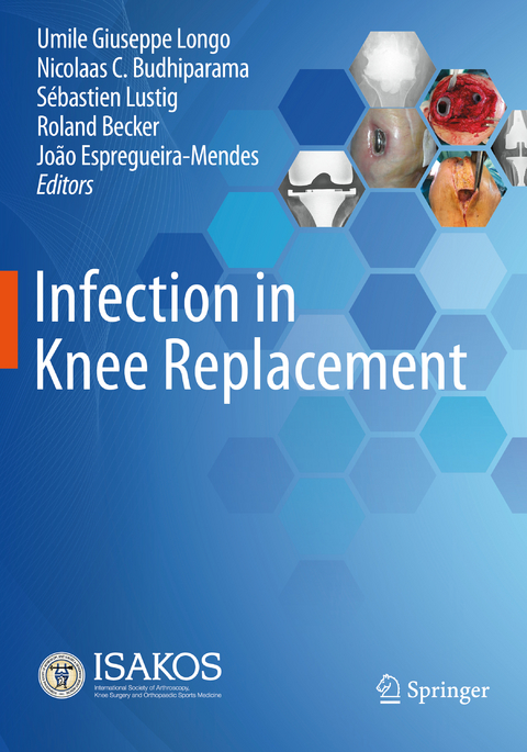 Infection in Knee Replacement - 