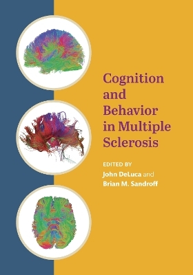 Cognition and Behavior in Multiple Sclerosis - 