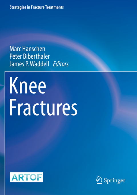 Knee Fractures - 