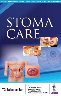 Stoma Care - TG Balachandar