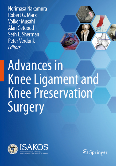 Advances in Knee Ligament and Knee Preservation Surgery - 