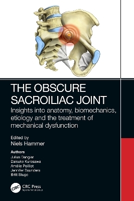 The Obscure Sacroiliac Joint - 