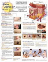 Understanding Skin Cancer Anatomical Chart - 