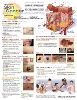 Understanding Skin Cancer Anatomical Chart