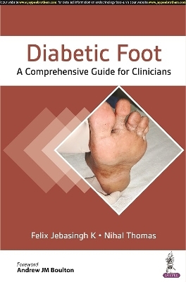 Diabetic Foot - Felix Jebasingh K, Nihal Thomas