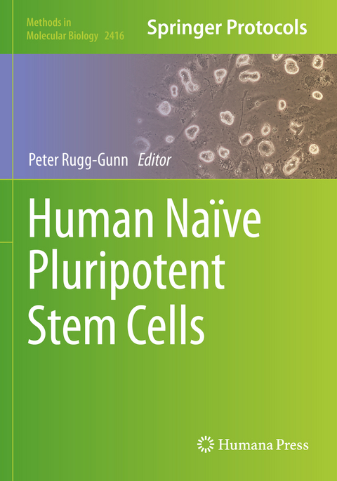 Human Naïve Pluripotent Stem Cells - 