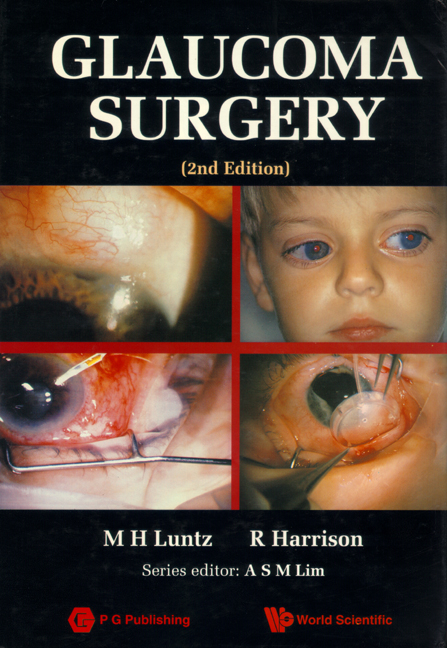 GLAUCOMA SURGERY (2ND EDITION) - Maurice H Luntz, Raymond Harrison