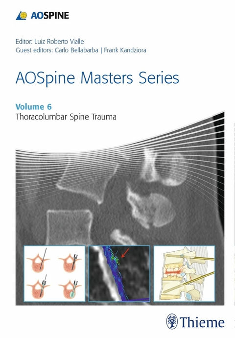 AOSpine Masters Series, Volume 6: Thoracolumbar Spine Trauma - 